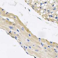 KCTD15 Antibody - Immunohistochemical analysis of KCTD15 staining in mouse lung formalin fixed paraffin embedded tissue section. The section was pre-treated using heat mediated antigen retrieval with sodium citrate buffer (pH 6.0). The section was then incubated with the antibody at room temperature and detected using an HRP conjugated compact polymer system. DAB was used as the chromogen. The section was then counterstained with hematoxylin and mounted with DPX.