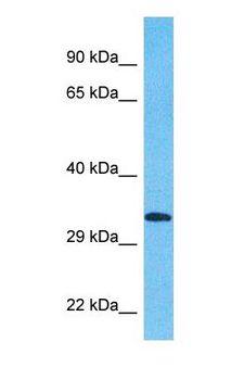 KCTD15 Antibody - Western blot of KCD15 Antibody with human NCI-H226 Whole Cell lysate.  This image was taken for the unconjugated form of this product. Other forms have not been tested.