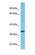 KCTD15 Antibody - Western blot of KCD15 Antibody with human NCI-H226 Whole Cell lysate.  This image was taken for the unconjugated form of this product. Other forms have not been tested.