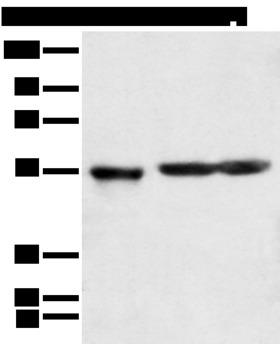 KCTD16 Antibody - Western blot analysis of Human cerebrum tissue rat brain tissue and Mouse brain tissue  using KCTD16 Polyclonal Antibody at dilution of 1:350