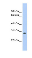 KCTD17 Antibody - KCTD17 antibody Western blot of HepG2 cell lysate. This image was taken for the unconjugated form of this product. Other forms have not been tested.
