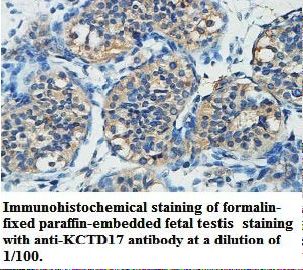 KCTD17 Antibody