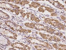 KCTD17 Antibody - Immunochemical staining of human KCTD17 in human stomach with rabbit polyclonal antibody at 1:500 dilution, formalin-fixed paraffin embedded sections.