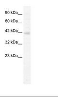 KCTD18 Antibody - Jurkat Cell Lysate.  This image was taken for the unconjugated form of this product. Other forms have not been tested.