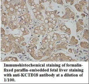 KCTD18 Antibody
