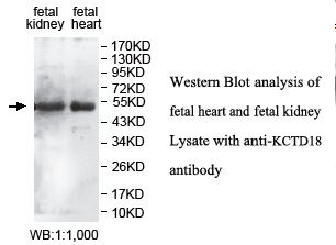 KCTD18 Antibody