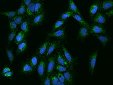 KCTD18 Antibody - Immunofluorescence staining of KCTD18 in U2OS cells. Cells were fixed with 4% PFA, permeabilzed with 0.1% Triton X-100 in PBS, blocked with 10% serum, and incubated with rabbit anti-Human KCTD18 polyclonal antibody (dilution ratio 1:200) at 4°C overnight. Then cells were stained with the Alexa Fluor 488-conjugated Goat Anti-rabbit IgG secondary antibody (green) and counterstained with DAPI (blue). Positive staining was localized to Cytoplasm.