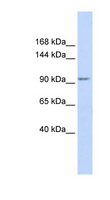 KCTD19 Antibody - KCTD19 antibody Western blot of Fetal Muscle lysate. This image was taken for the unconjugated form of this product. Other forms have not been tested.