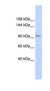 KCTD19 Antibody - KCTD19 antibody Western blot of Fetal Muscle lysate. This image was taken for the unconjugated form of this product. Other forms have not been tested.