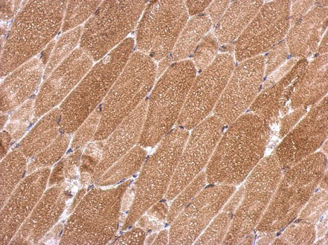 KCTD19 Antibody - IHC of paraffin-embedded Muscle, using KCTD19 antibody at 1:500 dilution.