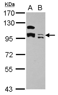 KCTD19 Antibody - Sample (30 ug of whole cell lysate) A: U87-MG B: SK-N-SH 7.5% SDS PAGE KCTD19 antibody diluted at 1:500