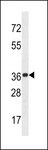 KCTD20 Antibody - KCTD20 Antibody western blot of mouse brain tissue lysates (35 ug/lane). The KCTD20 antibody detected the KCTD20 protein (arrow).