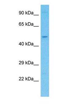 KCTD20 Antibody - Western blot of KCTD20 Antibody with human HeLa Whole Cell lysate.  This image was taken for the unconjugated form of this product. Other forms have not been tested.