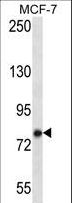 KCTD3 Antibody - KCTD3 Antibody western blot of MCF-7 cell line lysates (35 ug/lane). The KCTD3 antibody detected the KCTD3 protein (arrow).
