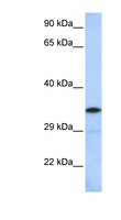 KCTD4 Antibody - KCTD4 antibody Western blot of MCF7 cell lysate. This image was taken for the unconjugated form of this product. Other forms have not been tested.