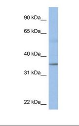 KCTD4 Antibody - Fetal heart lysate. Antibody concentration: 1.0 ug/ml. Gel concentration: 12%.  This image was taken for the unconjugated form of this product. Other forms have not been tested.