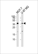 KCTD4 Antibody - Western blot of lysates from MCF-7, U-87 MG cell line (from left to right) with KCTD4 Antibody. Antibody was diluted at 1:1000 at each lane. A goat anti-rabbit IgG H&L (HRP) at 1:5000 dilution was used as the secondary antibody. Lysates at 35 ug per lane.
