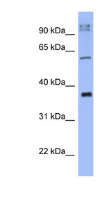 KCTD4 Antibody - KCTD4 antibody Western blot of THP-1 cell lysate. This image was taken for the unconjugated form of this product. Other forms have not been tested.