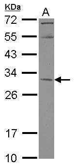 KCTD4 Antibody - Sample (30 ug of whole cell lysate) A: A431 12% SDS PAGE KCTD4 antibody diluted at 1:1000