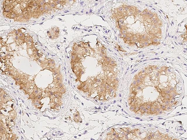 KCTD4 Antibody - Immunochemical staining of human Kctd4 in human testis with rabbit polyclonal antibody at 1:500 dilution, formalin-fixed paraffin embedded sections.