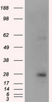 KCTD5 Antibody - HEK293T cells were transfected with the pCMV6-ENTRY control (Left lane) or pCMV6-ENTRY KCTD5 (Right lane) cDNA for 48 hrs and lysed. Equivalent amounts of cell lysates (5 ug per lane) were separated by SDS-PAGE and immunoblotted with anti-KCTD5.