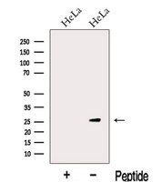 KCTD5 Antibody - Western blot analysis of extracts of HeLa cells using KCTD5 antibody. The lane on the left was treated with blocking peptide.