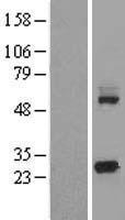 KCTD5 Protein - Western validation with an anti-DDK antibody * L: Control HEK293 lysate R: Over-expression lysate
