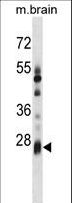 KCTD6 Antibody - KCTD6 Antibody western blot of mouse brain tissue lysates (35 ug/lane). The KCTD6 antibody detected the KCTD6 protein (arrow).