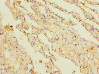 KCTD6 Antibody - Immunohistochemistry of paraffin-embedded human lung tissue using KCTD6 Antibody at dilution of 1:100