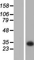 KCTD6 Protein - Western validation with an anti-DDK antibody * L: Control HEK293 lysate R: Over-expression lysate