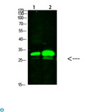 KCTD7 Antibody - Western Blot analysis of 1) mouse brain, 2) mouse heart cells using primary antibody diluted at 1: 1000 (4°C overnight) . Secondary antibody: Goat Anti-rabbit IgG IRDye 800 (diluted at 1: 5000, 25°C, 1 hour).