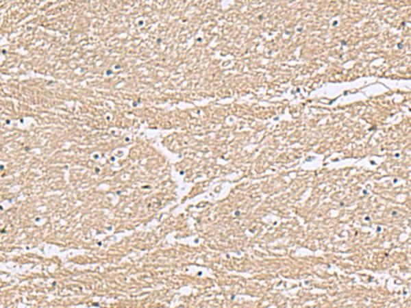 KCTD7 Antibody - Immunohistochemistry of paraffin-embedded Human brain tissue  using KCTD7 Polyclonal Antibody at dilution of 1:55(×200)
