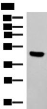 KCTD7 Antibody - Western blot analysis of Hela cell lysate  using KCTD7 Polyclonal Antibody at dilution of 1:1200