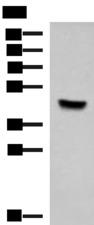 KCTD7 Antibody - Western blot analysis of Hela cell lysate  using KCTD7 Polyclonal Antibody at dilution of 1:1000