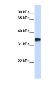 KCTD7 Antibody - KCTD7 antibody Western blot of Transfected 293T cell lysate. This image was taken for the unconjugated form of this product. Other forms have not been tested.