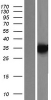 KCTD7 Protein - Western validation with an anti-DDK antibody * L: Control HEK293 lysate R: Over-expression lysate