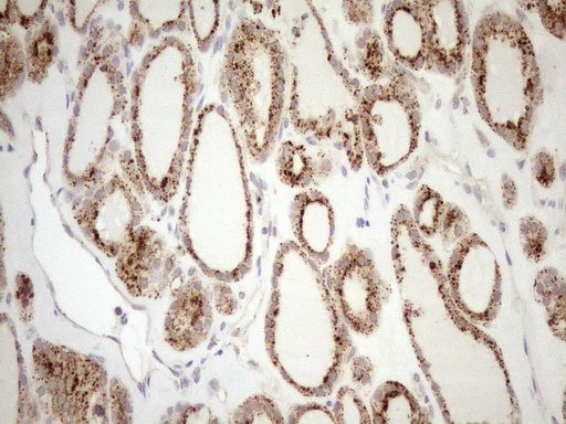 KCTD9 Antibody - Immunohistochemical staining of paraffin-embedded Human thyroid tissue within the normal limits using anti-KCTD9 mouse monoclonal antibody. (Heat-induced epitope retrieval by 1mM EDTA in 10mM Tris buffer. (pH8.5) at 120°C for 3 min. (1:150)