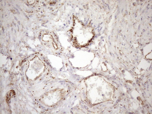 KCTD9 Antibody - Immunohistochemical staining of paraffin-embedded Human endometrium tissue within the normal limits using anti-KCTD9 mouse monoclonal antibody. (Heat-induced epitope retrieval by 1mM EDTA in 10mM Tris buffer. (pH8.5) at 120°C for 3 min. (1:150)