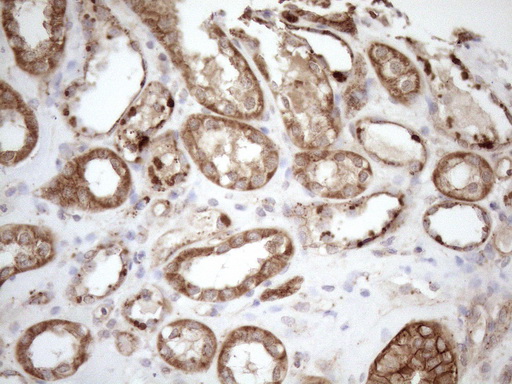 KCTD9 Antibody - Immunohistochemical staining of paraffin-embedded Human Kidney tissue within the normal limits using anti-KCTD9 mouse monoclonal antibody. (Heat-induced epitope retrieval by 1mM EDTA in 10mM Tris buffer. (pH8.5) at 120°C for 3 min. (1:150)