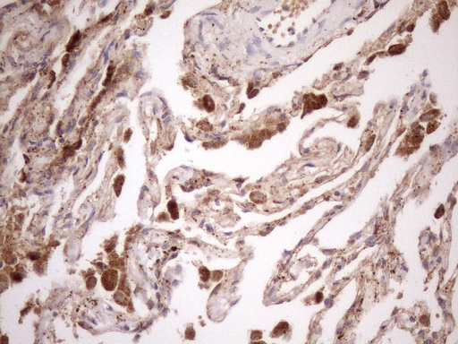 KCTD9 Antibody - Immunohistochemical staining of paraffin-embedded Human lung tissue within the normal limits using anti-KCTD9 mouse monoclonal antibody. (Heat-induced epitope retrieval by 1mM EDTA in 10mM Tris buffer. (pH8.5) at 120°C for 3 min. (1:150)