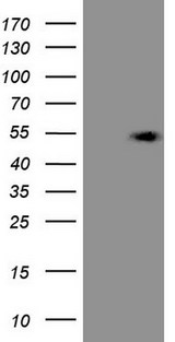 KCTD9 Antibody - HEK293T cells were transfected with the pCMV6-ENTRY control. (Left lane) or pCMV6-ENTRY KCTD9. (Right lane) cDNA for 48 hrs and lysed
