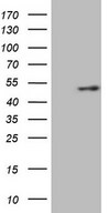 KCTD9 Antibody - HEK293T cells were transfected with the pCMV6-ENTRY control. (Left lane) or pCMV6-ENTRY KCTD9. (Right lane) cDNA for 48 hrs and lysed