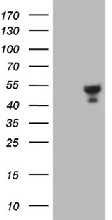 KCTD9 Antibody - HEK293T cells were transfected with the pCMV6-ENTRY control. (Left lane) or pCMV6-ENTRY KCTD9. (Right lane) cDNA for 48 hrs and lysed. Equivalent amounts of cell lysates. (5 ug per lane) were separated by SDS-PAGE and immunoblotted with anti-KCTD9. (1:500)