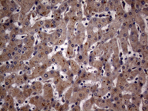 KCTD9 Antibody - Immunohistochemical staining of paraffin-embedded Human liver tissue within the normal limits using anti-KCTD9 mouse monoclonal antibody. (Heat-induced epitope retrieval by 1mM EDTA in 10mM Tris buffer. (pH8.5) at 120°C for 3 min. (1:150)