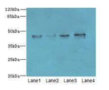 KCTD9 Antibody - Western blot. All lanes: KCTD9 antibody at 8 ug/ml. Lane 1: MCF7 whole cell lysate. Lane 2: HepG-2 whole cell lysate. Lane 3: HT29 whole cell lysate. Lane 4: U251 whole cell lysate. Secondary Goat polyclonal to Rabbit IgG at 1:10000 dilution. Predicted band size: 43 kDa. Observed band size: 43 kDa.