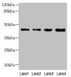 KCTD9 Antibody - Western blot All lanes: KCTD9 antibody at 8µg/ml Lane 1: MCF-7 whole cell lysate Lane 2: HepG2 whole cell lysate Lane 3: HT29 whole cell lysate Lane 4: U251 whole cell lysate Secondary Goat polyclonal to rabbit IgG at 1/10000 dilution Predicted band size: 43 kDa Observed band size: 43 kDa