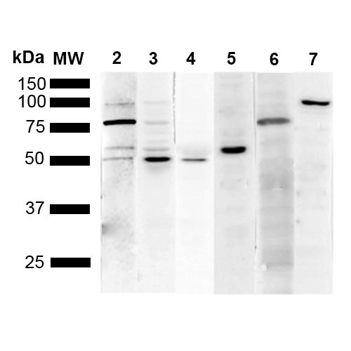 KDEL Tetrapeptide Antibody - Western Blot analysis of Human Cervical cancer cell line (HeLa) lysate showing detection of Multiple KDEL protein using Mouse Anti-KDEL Monoclonal Antibody, Clone 1F2. Lane 1: Molecular Weight Ladder (MW). Lane 2: Anti-KDEL. Lane 3: Anti-KDEL control. Lane 4: Anti-PDI control. Lane 5: Anti-Calreticulin control. Lane 6: Anti-GRP78 control. Lane 7: Anti-GRP94 control.. Load: 10 µg. Block: 5% Skim Milk powder in TBST. Primary Antibody: Mouse Anti-KDEL Monoclonal Antibody  at 1:1000 for 2 hours at RT. Secondary Antibody: Goat Anti-Mouse IgG:HRP at 1:5000 for 1 hour at RT. Color Development: ECL solution for 5 min in RT. Predicted/Observed Size: Multiple.