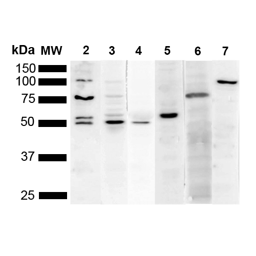 KDEL Tetrapeptide Antibody - Western Blot analysis of Human Cervical cancer cell line (HeLa) lysate showing detection of Multiple KDEL protein using Mouse Anti-KDEL Monoclonal Antibody, Clone 2C1. Lane 1: Molecular Weight Ladder (MW). Lane 2: Anti-KDEL. Lane 3: Anti-KDEL control. Lane 4: Anti-PDI control. Lane 5: Anti-Calreticulin control. Lane 6: Anti-GRP78 control. Lane 7: Anti-GRP94 control.. Load: 10 µg. Block: 5% Skim Milk powder in TBST. Primary Antibody: Mouse Anti-KDEL Monoclonal Antibody  at 1:1000 for 2 hours at RT. Secondary Antibody: Goat Anti-Mouse IgG:HRP at 1:5000 for 1 hour at RT. Color Development: ECL solution for 5 min in RT. Predicted/Observed Size: Multiple.
