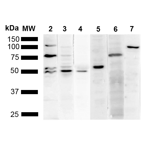 KDEL Tetrapeptide Antibody - Western Blot analysis of Human Cervical cancer cell line (HeLa) lysate showing detection of Multiple KDEL protein using Mouse Anti-KDEL Monoclonal Antibody, Clone 2D6. Lane 1: Molecular Weight Ladder (MW). Lane 2: Anti-KDEL. Lane 3: Anti-KDEL control. Lane 4: Anti-PDI control. Lane 5: Anti-Calreticulin control. Lane 6: Anti-GRP78 control. Lane 7: Anti-GRP94 control.. Load: 10 µg. Block: 5% Skim Milk powder in TBST. Primary Antibody: Mouse Anti-KDEL Monoclonal Antibody  at 1:1000 for 2 hours at RT. Secondary Antibody: Goat Anti-Mouse IgG:HRP at 1:5000 for 1 hour at RT. Color Development: ECL solution for 5 min in RT. Predicted/Observed Size: Multiple.