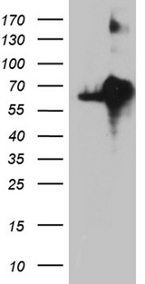 KDELC2 Antibody - HEK293T cells were transfected with the pCMV6-ENTRY control. (Left lane) or pCMV6-ENTRY KDELC2. (Right lane) cDNA for 48 hrs and lysed. Equivalent amounts of cell lysates. (5 ug per lane) were separated by SDS-PAGE and immunoblotted with anti-KDELC2. (1:2000)